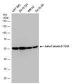 beta-3 Tubulin Antibody in Western Blot (WB)