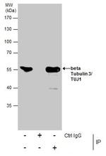 beta-3 Tubulin Antibody in Immunoprecipitation (IP)