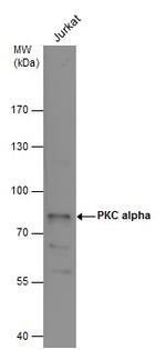 PKC alpha Antibody in Western Blot (WB)