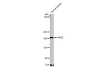 ACE Antibody in Western Blot (WB)