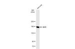 ACE Antibody in Western Blot (WB)