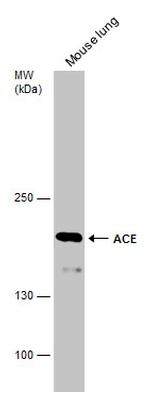 ACE Antibody in Western Blot (WB)