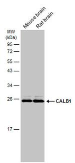 Calbindin D28K Antibody in Western Blot (WB)