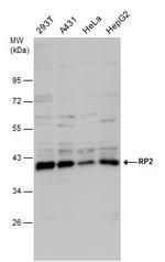 RP2 Antibody in Western Blot (WB)