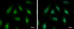 PYK2 Antibody in Immunocytochemistry (ICC/IF)