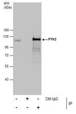 PYK2 Antibody in Immunoprecipitation (IP)