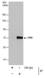 PKR Antibody in Immunoprecipitation (IP)