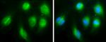 Thrombospondin 1 Antibody in Immunocytochemistry (ICC/IF)