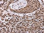 DHX9 Antibody in Immunohistochemistry (Paraffin) (IHC (P))