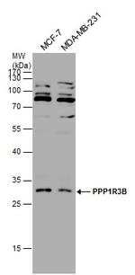 PPP1R3B Antibody in Western Blot (WB)