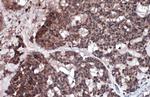 RIP3 Antibody in Immunohistochemistry (Paraffin) (IHC (P))