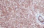 UCP1 Antibody in Immunohistochemistry (Paraffin) (IHC (P))