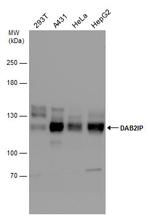 DAB2IP Antibody in Western Blot (WB)