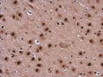 BARD1 Antibody in Immunohistochemistry (Paraffin) (IHC (P))