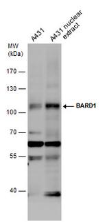 BARD1 Antibody in Western Blot (WB)