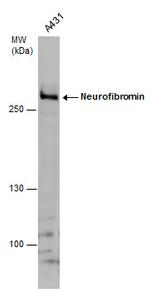 NF1 Antibody in Western Blot (WB)