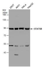 STAT5 beta Antibody in Western Blot (WB)