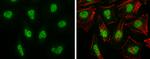 BRG1 Antibody in Immunocytochemistry (ICC/IF)