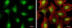 ATM Antibody in Immunocytochemistry (ICC/IF)