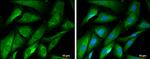 Huntingtin Antibody in Immunocytochemistry (ICC/IF)