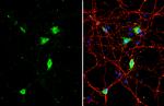 BDNF Antibody in Immunocytochemistry (ICC/IF)