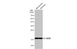 BDNF Antibody in Western Blot (WB)