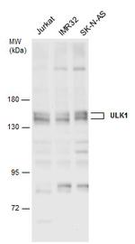 ULK1 Antibody in Western Blot (WB)