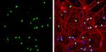 OLIG2 Antibody in Immunocytochemistry (ICC/IF)