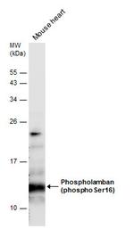 Phospho-Phospholamban (Ser16) Antibody in Western Blot (WB)