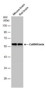 CaMKII beta Antibody in Western Blot (WB)