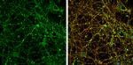 PSD-95 Antibody in Immunocytochemistry (ICC/IF)