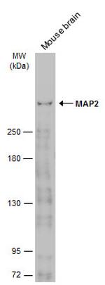 MAP2 Antibody in Western Blot (WB)