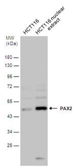 Phospho-PAX2 (Ser393) Antibody in Western Blot (WB)