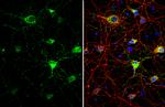 Somatostatin Antibody in Immunocytochemistry (ICC/IF)