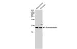 Somatostatin Antibody in Western Blot (WB)