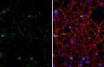 Somatostatin Antibody in Immunocytochemistry (ICC/IF)