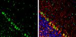 Somatostatin Antibody in Immunohistochemistry (Frozen) (IHC (F))