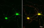 VGLUT1 Antibody in Immunocytochemistry (ICC/IF)