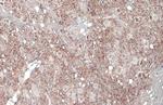 VGLUT1 Antibody in Immunohistochemistry (Paraffin) (IHC (P))