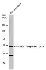 SLC6A1 Antibody in Western Blot (WB)