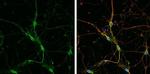 SLC6A1 Antibody in Immunocytochemistry (ICC/IF)