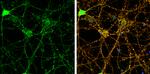 PSD-95 Antibody in Immunocytochemistry (ICC/IF)