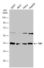 TBP Antibody in Western Blot (WB)