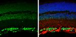 OTX2 Antibody in Immunohistochemistry (Paraffin) (IHC (P))