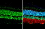 OTX2 Antibody in Immunohistochemistry (Paraffin) (IHC (P))