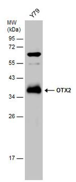 OTX2 Antibody in Western Blot (WB)