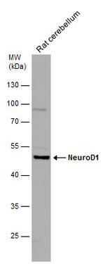 NeuroD1 Antibody in Western Blot (WB)