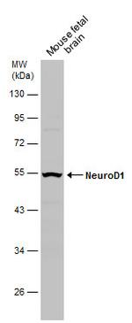 NeuroD1 Antibody in Western Blot (WB)