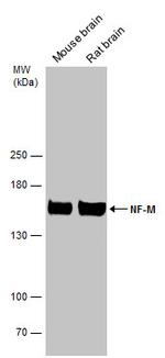 NEFM Antibody in Western Blot (WB)