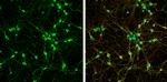 NEFM Antibody in Immunocytochemistry (ICC/IF)